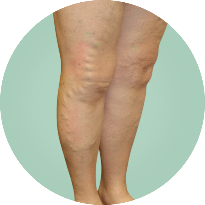 WholeBody Massager™ (Muscle Pain Relief Device) nooro AU